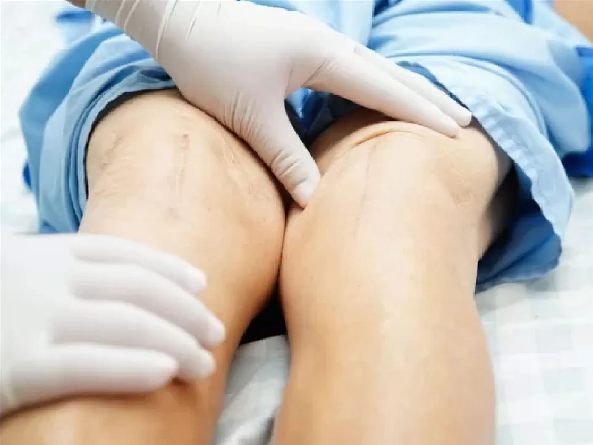 Periferik Arter/Ven Hastalıklarının Tedavileri