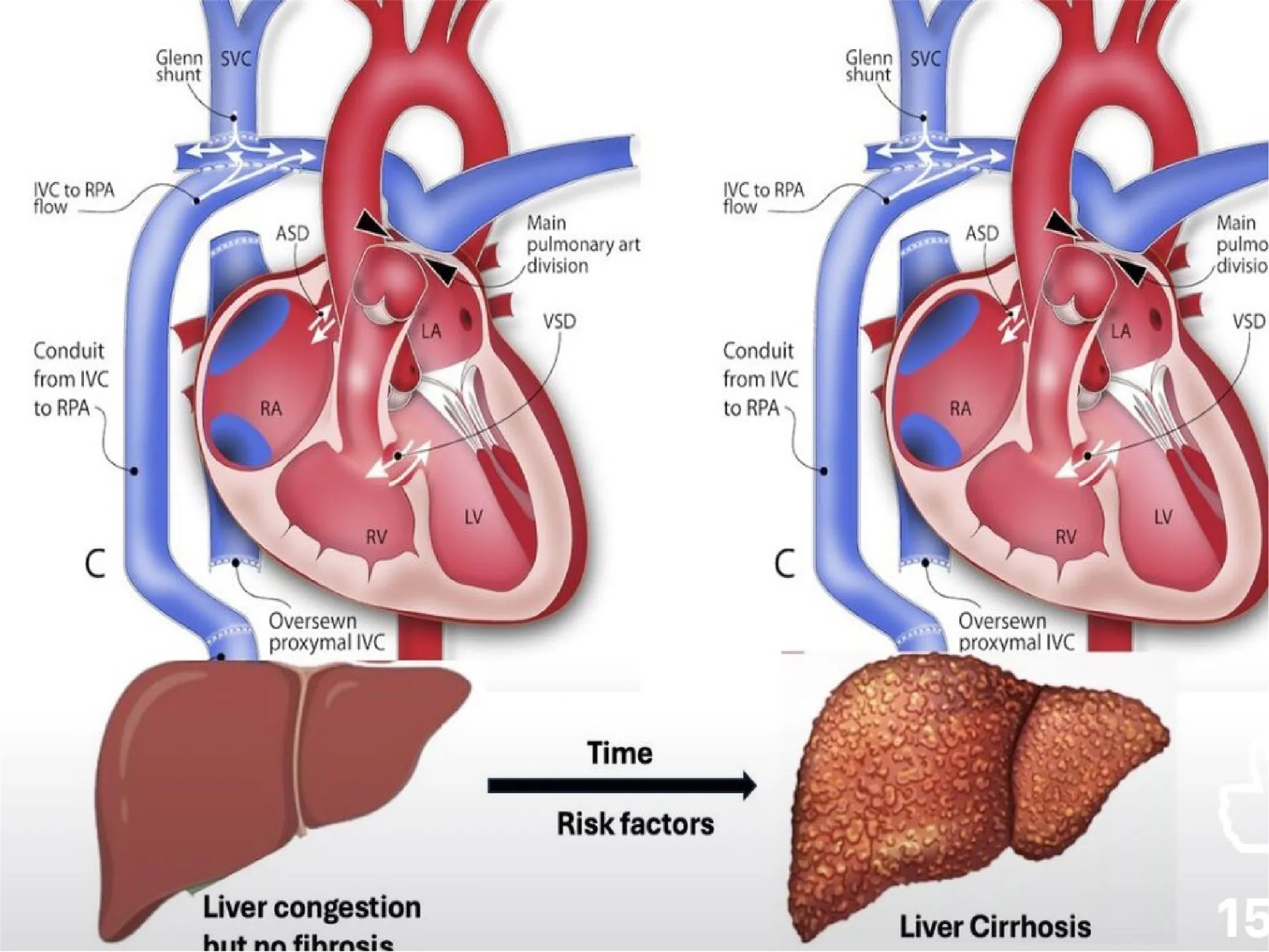 Girişimsel Radyoloji